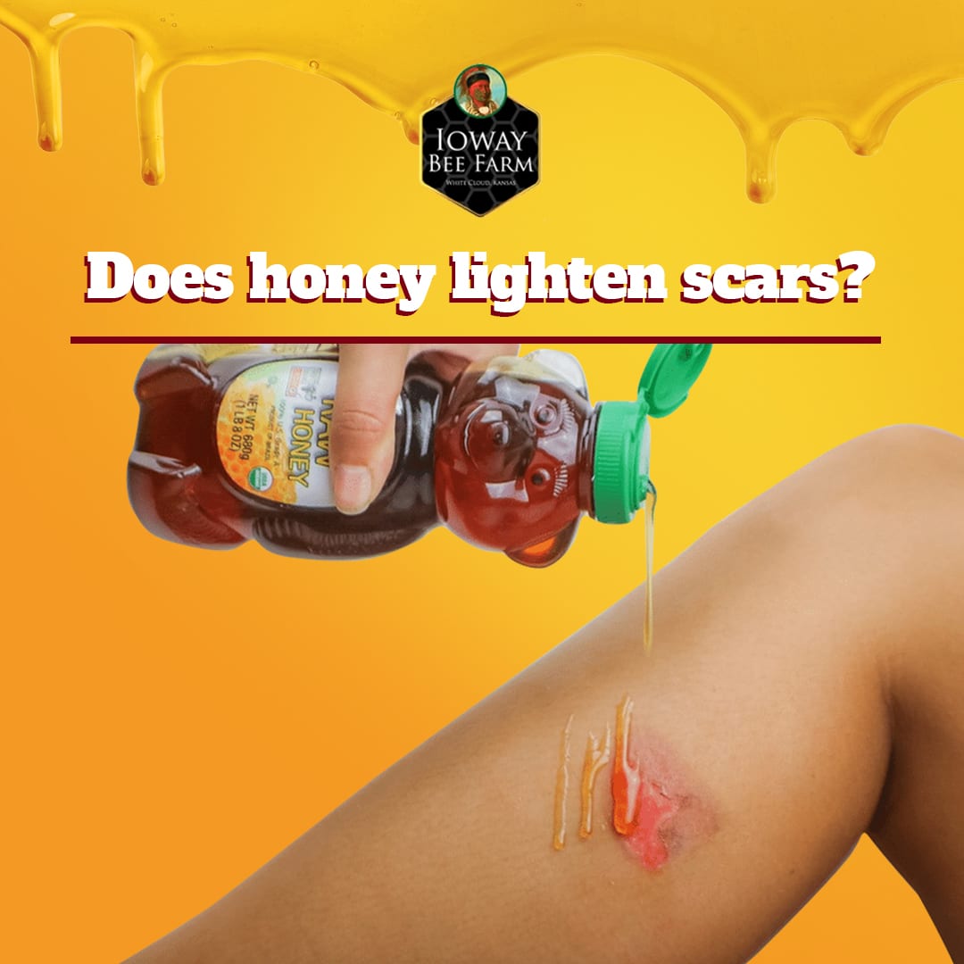 آیا عسل برای درمان زخم مفید است؟